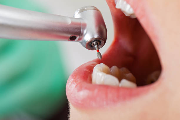 Best Emergency Treatment for Toothache in Milton Freewater, OR